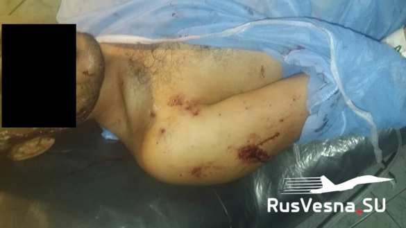 Страна НАТО и террористы вместе наносят удары в Сирии (ФОТО) | Русская весна