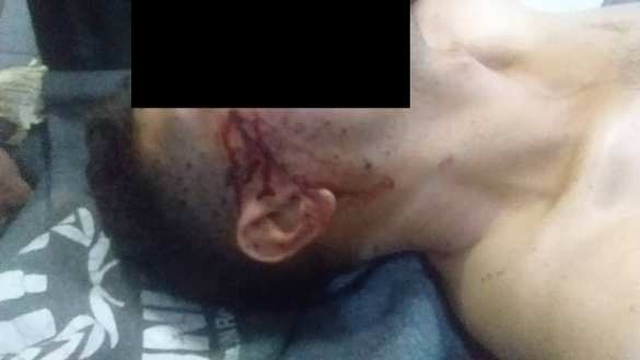 Страна НАТО и террористы вместе наносят удары в Сирии (ФОТО) | Русская весна