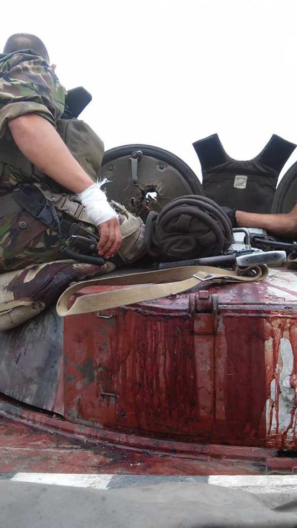 Карательный Батальон «Донбасс» столкнулся с «Призраком» Мозгового, 2 нациста убиты, 6 ранены (фото лента) | Русская весна