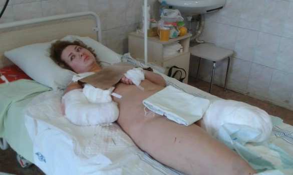 Помочь Юле. Помочь всем — неравнодушные люди берут под свою опеку пострадавших жителей Донбасса | Русская весна