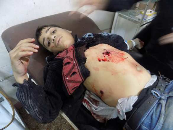 Bloody terror in Aleppo supported by Turkish, Saudi and Israeli intelligence services (VIDEO, PHOTOS 18+) | Русская весна