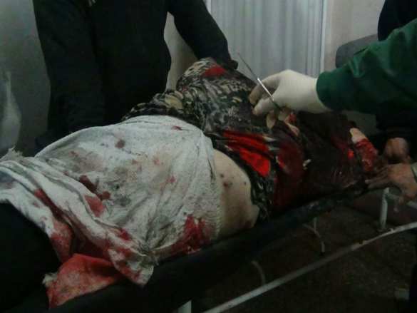 Bloody terror in Aleppo supported by Turkish, Saudi and Israeli intelligence services (VIDEO, PHOTOS 18+) | Русская весна