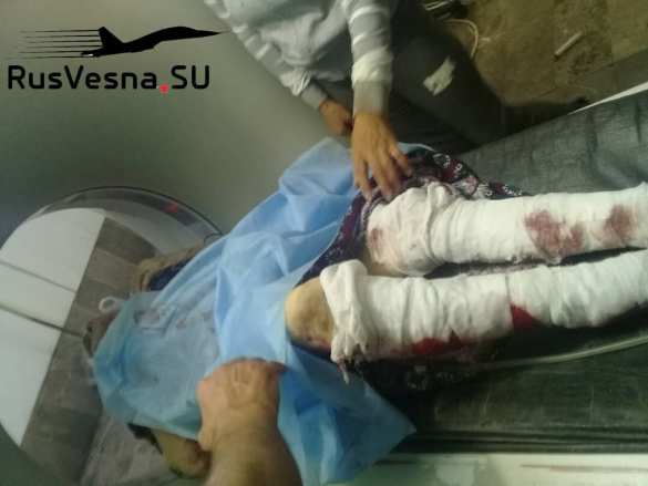 Турки наносят удары по Сирии (ФОТО) | Русская весна