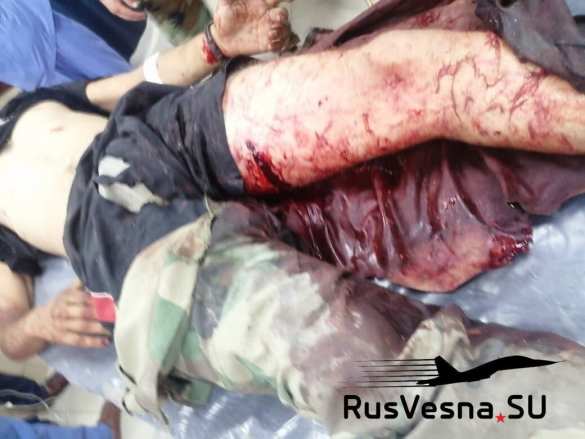 Враг нанёс удар по военным в Сирии (ФОТО 18+) | Русская весна