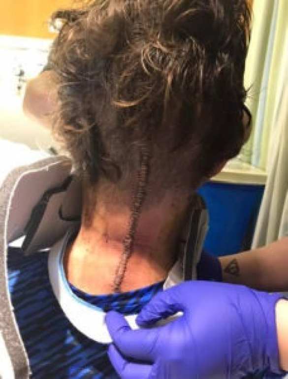 Мужчина выжил после того, как ему «оторвало голову» в ДТП (ФОТО) | Русская весна