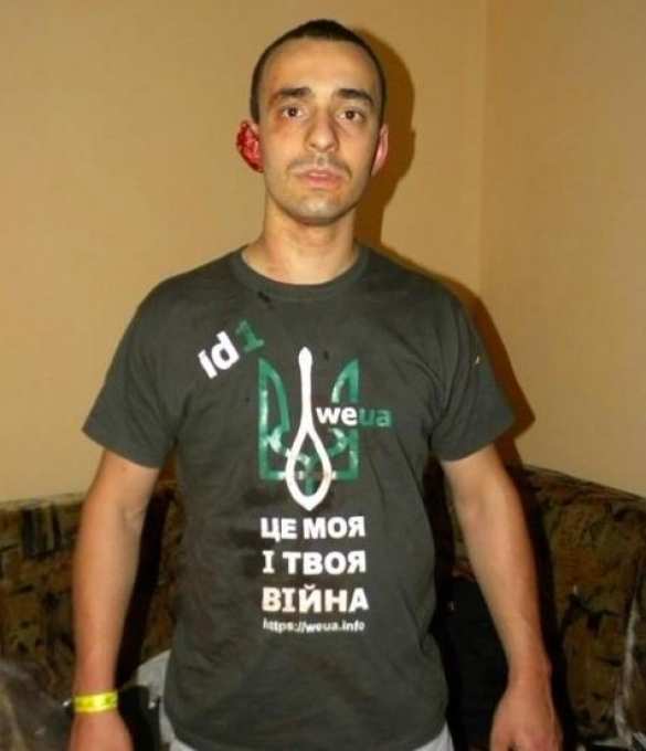 Львовскому активисту в драке откусил кусок уха прохожий, скандировавший «Слава Путину!» | Русская весна