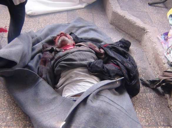 Aleppo Bloodbath: «Nusra» attacks and prepares to use Turkish chemical weapon (VIDEO, PHOTOS 18+) | Русская весна