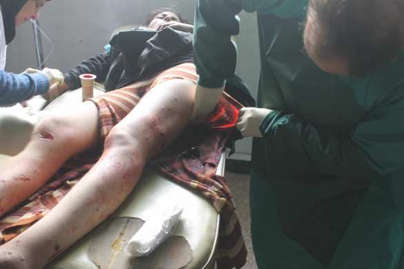 Aleppo escalation — «an-Nusra» advances killing civilians, Russia to dispatch humanitarian convoy (PHOTOS 18+) | Русская весна