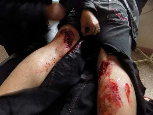 Aleppo escalation — «an-Nusra» advances killing civilians, Russia to dispatch humanitarian convoy (PHOTOS 18+) | Русская весна