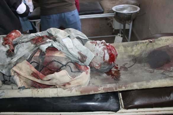 Aleppo escalation — «an-Nusra» advances killing civilians, Russia to dispatch humanitarian convoy (PHOTOS 18+) | Русская весна