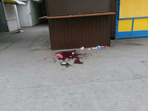 Луганск, улицы залиты кровью, десятки убитых и раненых — материалы для трибунала (фото/видео лента 18+) | Русская весна