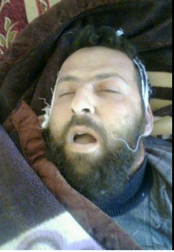 Кровавая жатва под Дамаском: командиры террористов становятся жертвами разборок между группировками (ФОТО 18+) | Русская весна