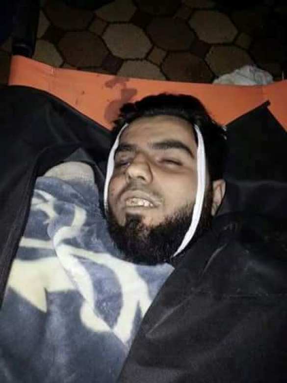 Протурецкие боевики в котле: Армия Сирии уничтожила комбата «Аль-Наср» и разблокировала армянский Кесаб (КАРТА+ФОТО 18+) | Русская весна