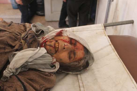 Алеппо в «адском огне»: боевики убивают жителей и терроризируют город (ВИДЕО, ФОТО 18+) | Русская весна