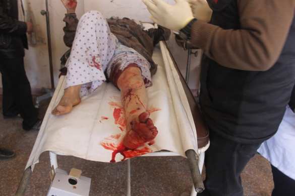 Алеппо в «адском огне»: боевики убивают жителей и терроризируют город (ВИДЕО, ФОТО 18+) | Русская весна