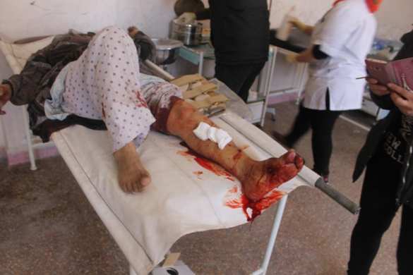 Алеппо в «адском огне»: боевики убивают жителей и терроризируют город (ВИДЕО, ФОТО 18+) | Русская весна