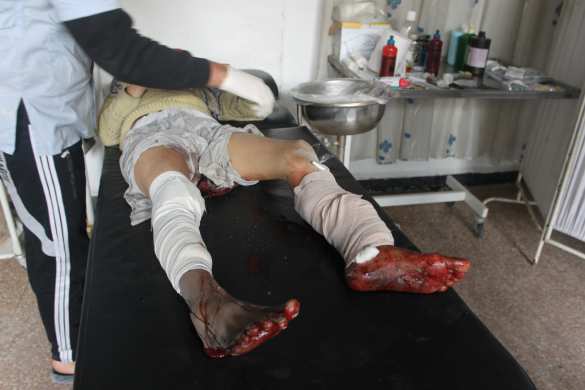 Дети Алеппо были приговорены западными лицемерами, — сенатор Саблин (ВИДЕО, ФОТО 18+) | Русская весна