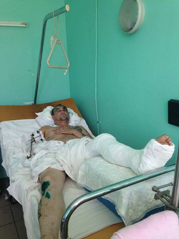 В поезде «Запорожье-Мариуполь» избили «героя АТО» и выбросили из вагона (ФОТО) | Русская весна