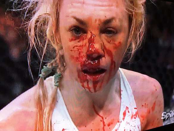 «Это была бойня!»: Сеть взрывает поединок женщин-бойцов ММА (ФОТО, ВИДЕО 18+) | Русская весна