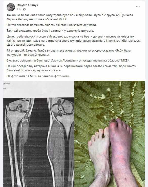 Боевику ВСУ посоветовали отрезать ногу, чтобы получить положенные льготы | Русская весна