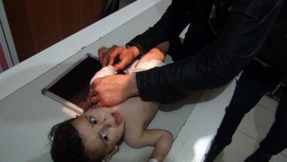 Кровавая ночь в Африне: после турецкого обстрела убиты и ранены дети, в больнице идут операции (ФОТО, ВИДЕО 18+) | Русская весна