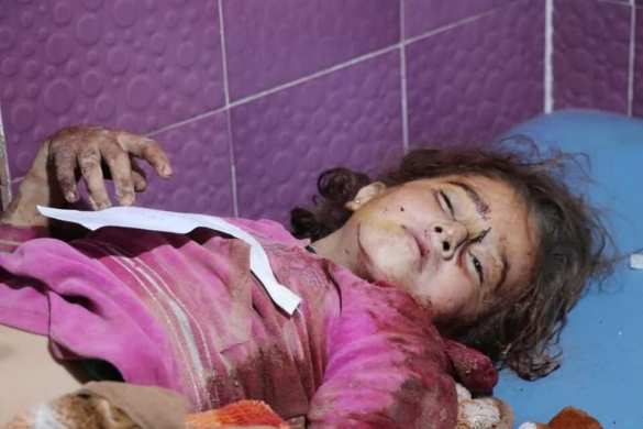 Operation &quot;Genocide&quot;: more than 500 dead - terrible pictures of mass atrocities in northern Syria (PHOTO, VIDEO 18+) | Русская весна