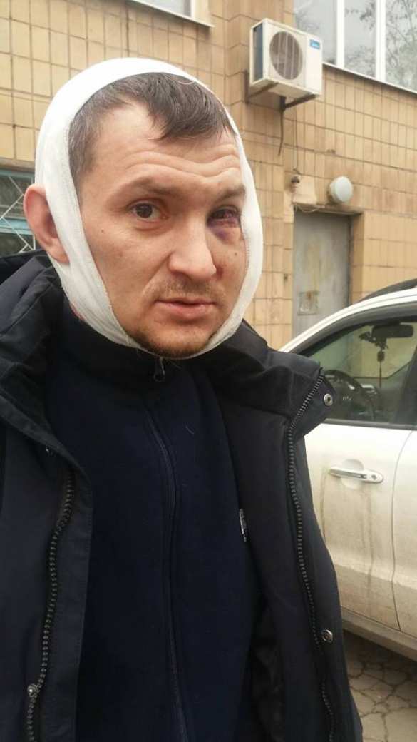 «Я попал в мясорубку»: в Мариуполе спецназовцы зверски избили местных жителей (ФОТО) | Русская весна