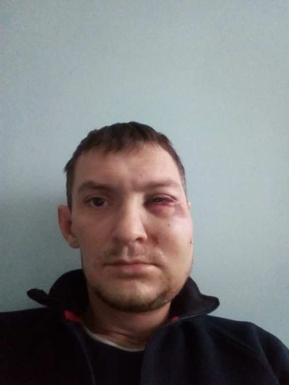 «Я попал в мясорубку»: в Мариуполе спецназовцы зверски избили местных жителей (ФОТО) | Русская весна