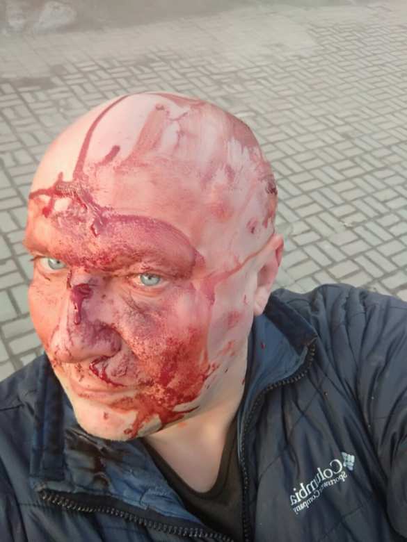 В Киеве проломили голову известному догхантеру (ФОТО 18+) | Русская весна