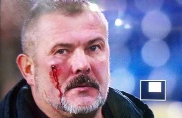 Майданутого «атошника» и нардепа Березу фанаты «Днепра» избили прямо во время футбольного матча (ФОТО, ВИДЕО) | Русская весна