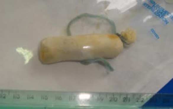 Украинец пытался провезти наркотики в Крым в прямой кишке, — ФСКН (ФОТО) | Русская весна