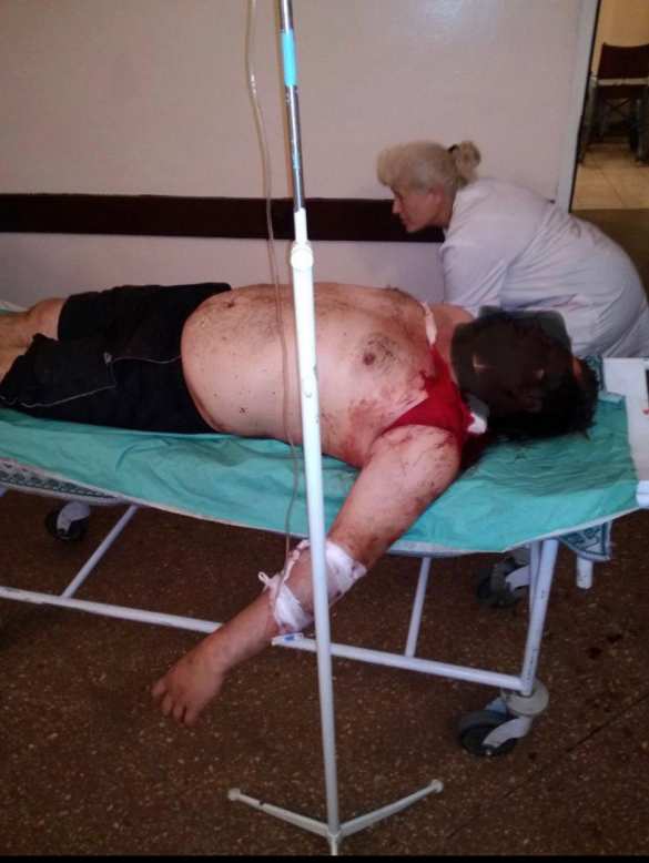 СРОЧНО: ВСУ нанесли удар по Горловке, ранен мирный житель (+ФОТО) | Русская весна