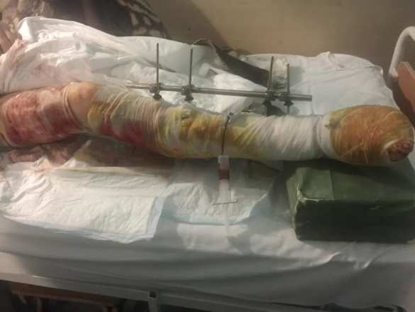 Ужас ВСУ: стремление выжить (ФОТО) | Русская весна