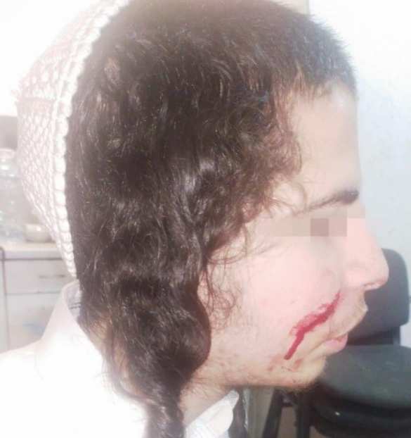 На Украине напали с ножом на хасидов-подростков (ФОТО, ВИДЕО) | Русская весна