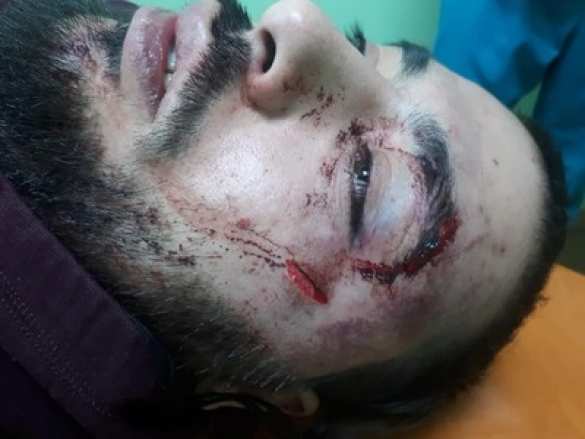 В Умани вооружённая толпа антисемитов избила евреев (ФОТО 18+) | Русская весна