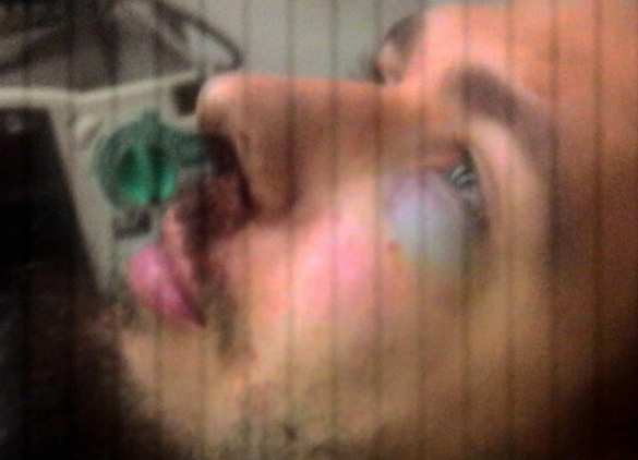 В Харькове жестоко избили известного неонациста (ФОТО) | Русская весна