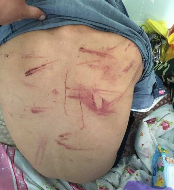 Дикая Украина: Мужчины зверски пытали и насиловали подростка из-за девушки (ФОТО, ВИДЕО) | Русская весна