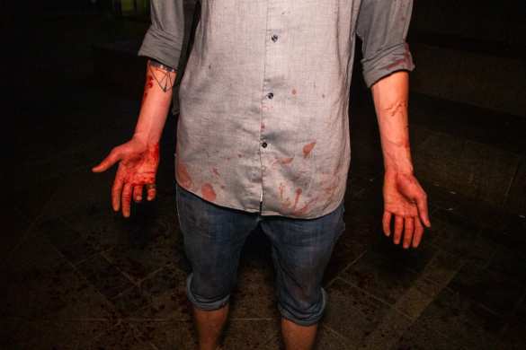 Кровавая поножовщина на Майдане: парню изрезали лицо ножом (ФОТО, ВИДЕО 18+) | Русская весна