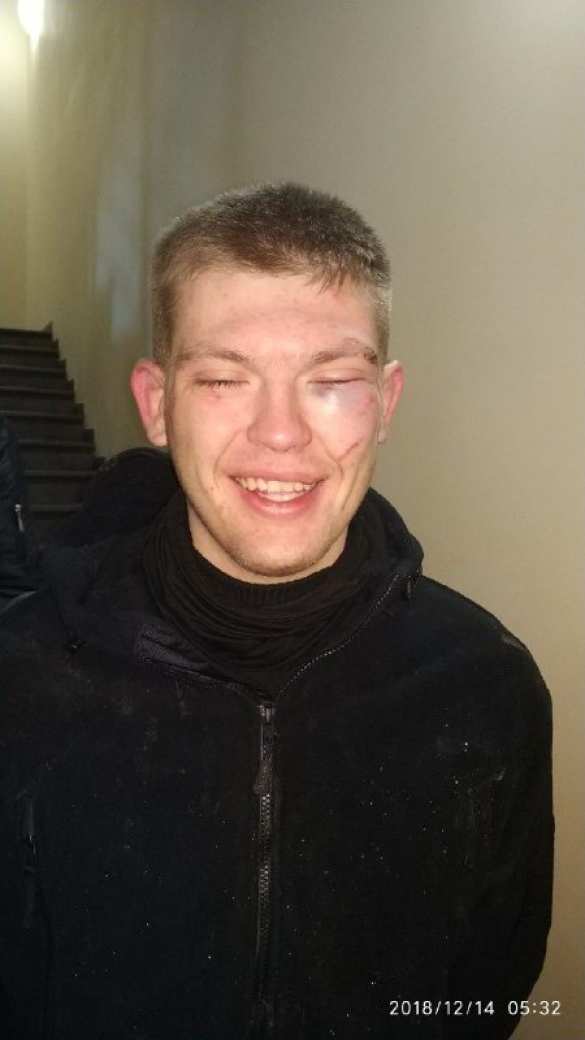 Типичная Украина: В Киеве вооружённая банда напала на АЗС (ФОТО) | Русская весна