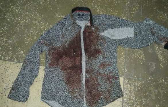 СРОЧНО: Перестрелка в центре Киева, есть погибший (ФОТО) | Русская весна