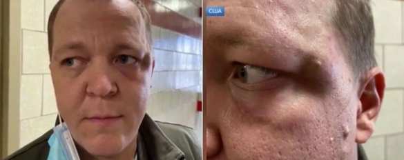 Ограблены и избиты: на российских журналистов напали в США (ФОТО) | Русская весна