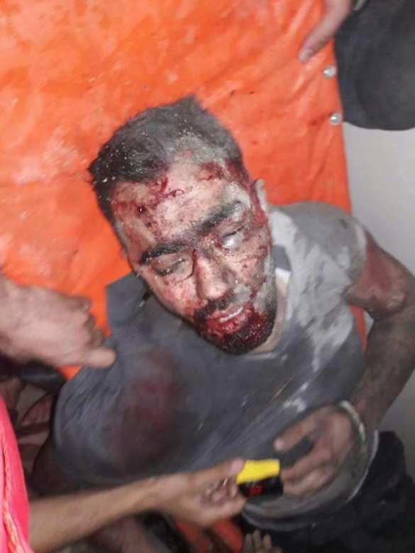 Кровавая жатва: «Ан-Нусра» признала потерю 200 боевиков за две недели в Алеппо и Латакии (ВИДЕО, ФОТО 18+) | Русская весна