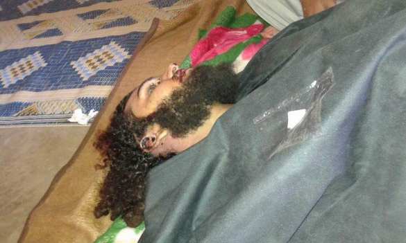 Ад в Алеппо: наступление банд обернулось кровавым провалом — убиты сотни боевиков (КАРТА, ВИДЕО, ФОТО 18+) | Русская весна