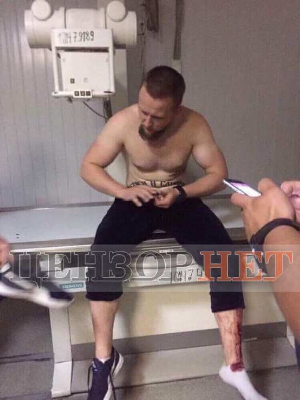 Появились кадры расстрела «атошников» в Днепропетровске (ФОТО, ВИДЕО 18+) | Русская весна