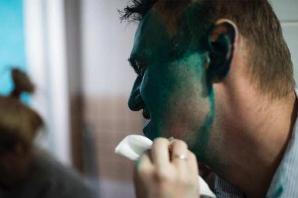 Навального облили зеленкой в Барнауле (ФОТО, ВИДЕО) | Русская весна