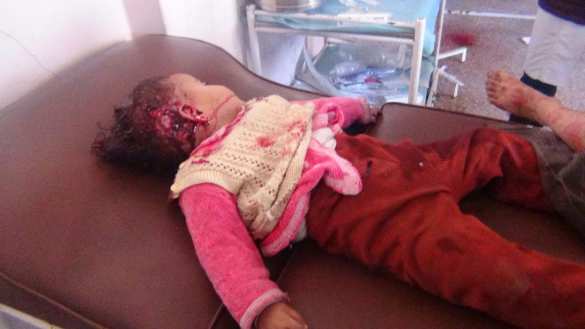 Дети Алеппо были приговорены западными лицемерами, — сенатор Саблин (ВИДЕО, ФОТО 18+) | Русская весна