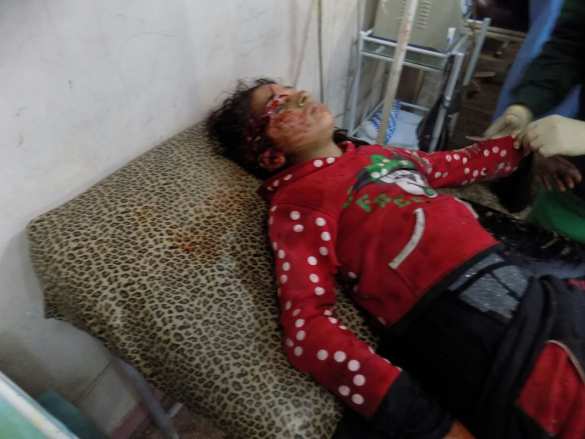 Дети Алеппо были приговорены западными лицемерами, — сенатор Саблин (ВИДЕО, ФОТО 18+) | Русская весна