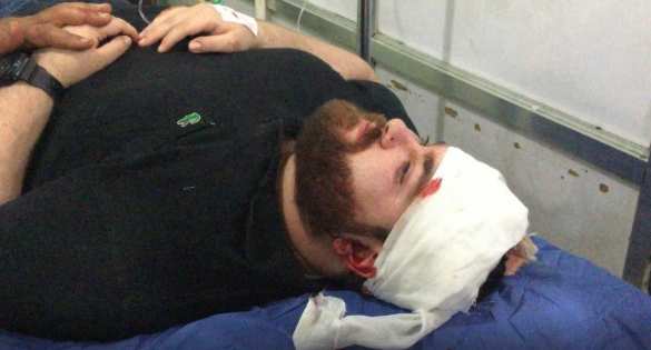 Алеппо в крови: боевики наносят новый удар (ФОТО 18+) | Русская весна