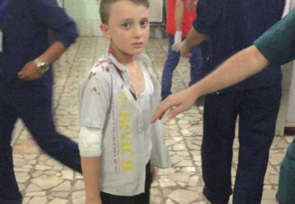 Алеппо в крови: боевики наносят новый удар (ФОТО 18+) | Русская весна