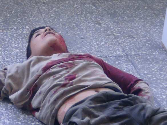 Дети Алеппо были приговорены западными лицемерами, — сенатор Саблин (ВИДЕО, ФОТО 18+) | Русская весна